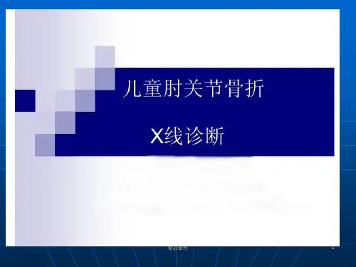 儿童肘关节骨折X线PPT课件