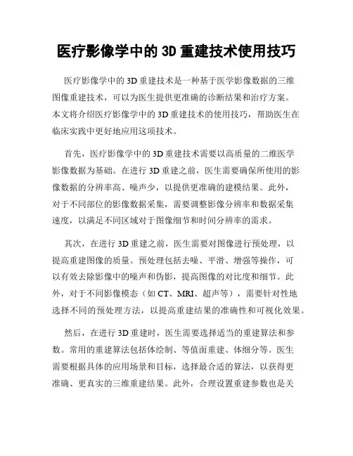 医疗影像学中的3D重建技术使用技巧
