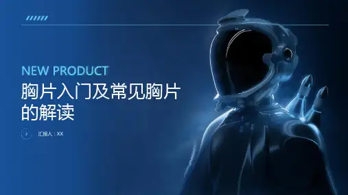 胸片入门及常见胸片的解读