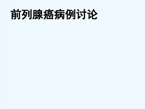 前列腺癌病例讨论