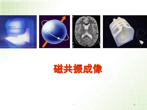 磁共振成像(医学影像成像原理)PPT参考课件
