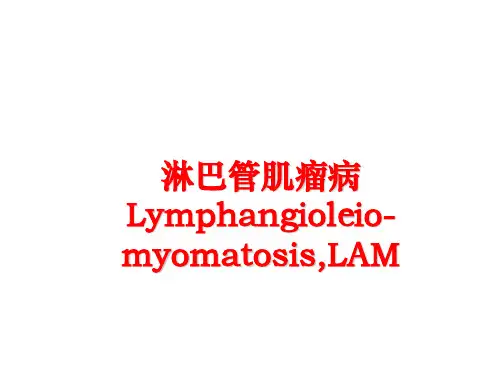 最新淋巴管肌瘤病Lymphangioleio-myomatosis,LAM