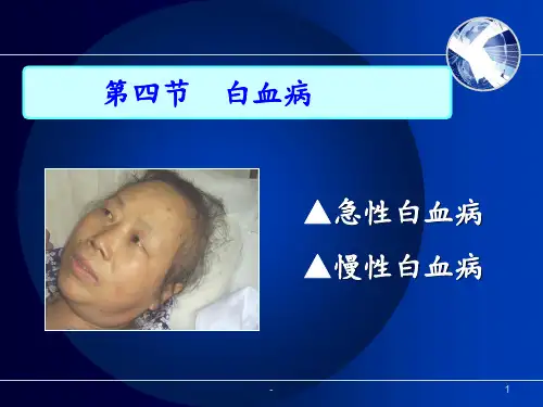 慢性淋巴细胞白血病PPT课件
