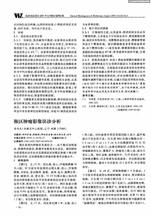 鞍区肿瘤影像误诊分析