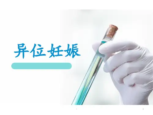 异位妊娠的查房PPT课件