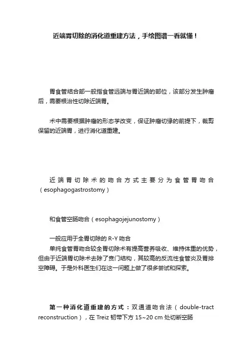 近端胃切除的消化道重建方法，手绘图谱一看就懂！
