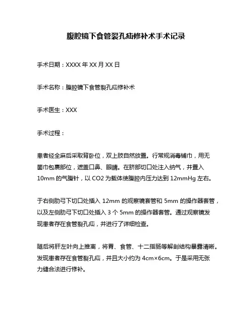 腹腔镜下食管裂孔疝修补术手术记录