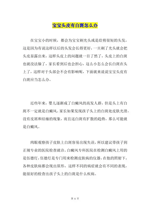 宝宝头皮有白斑怎么办