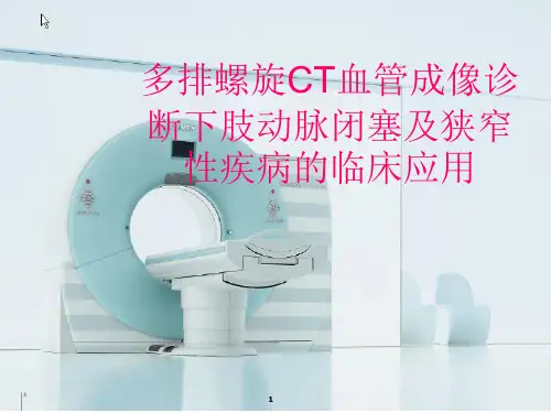 下肢动脉闭塞及狭窄性疾病的CTA诊断ppt课件