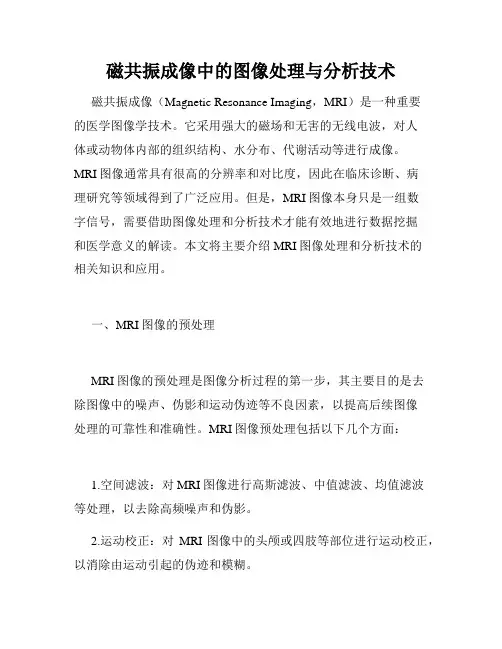 磁共振成像中的图像处理与分析技术