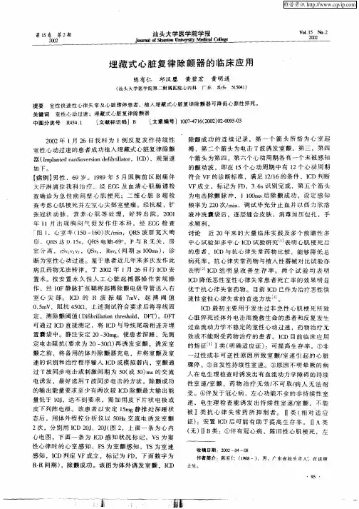 埋藏式心脏复律除颤器的临床应用