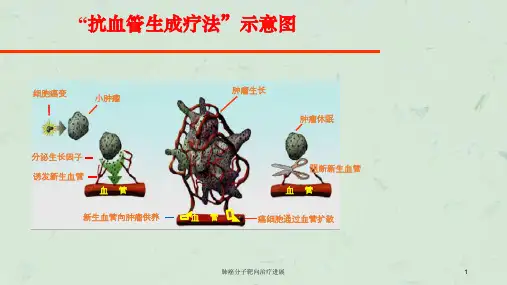 肺癌分子靶向治疗进展课件