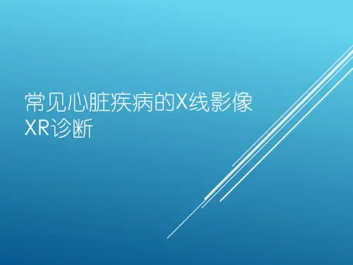 常见心脏疾病的X线影像XR诊断