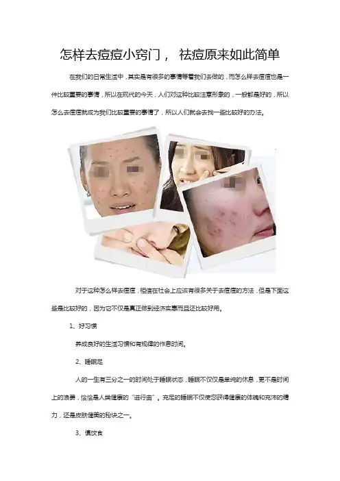怎样去痘痘小窍门, 祛痘原来如此简单