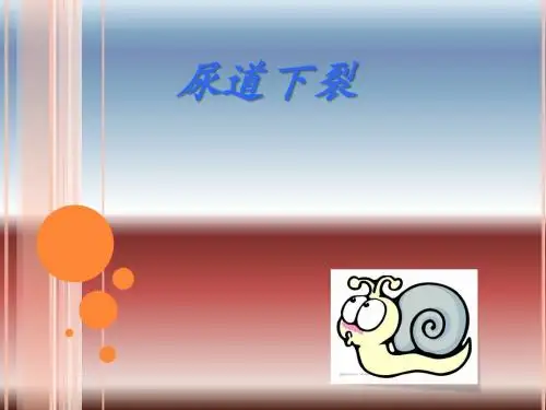 尿道下裂