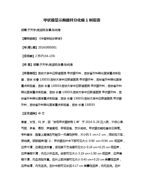 甲状腺显示胸腺样分化癌1例报道