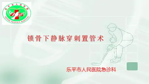 锁骨下静脉穿刺置管术1(1)