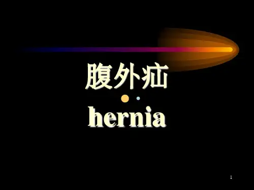 腹外疝ppt课件