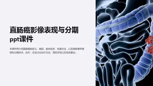 直肠癌影像表现与分期课件