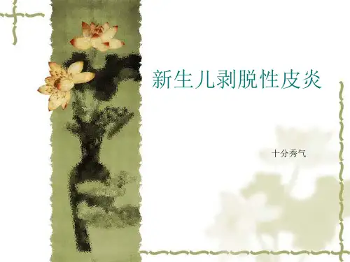 剥脱性皮炎