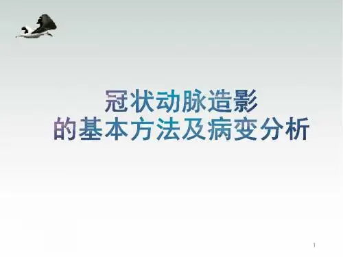 冠状动脉造影的基本方法及病变分析幻灯片课件