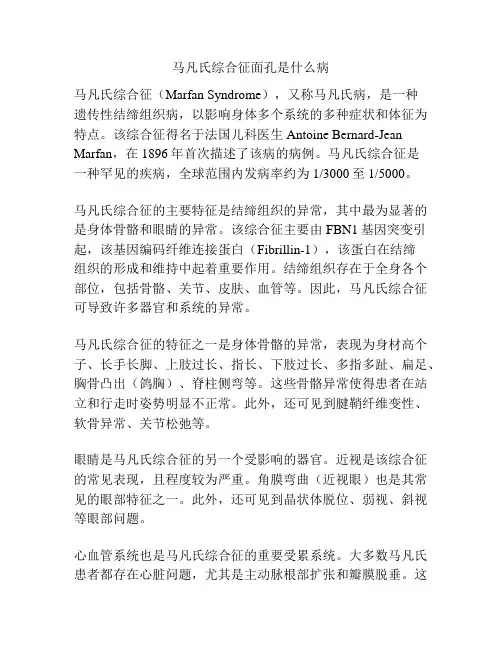马凡氏综合征面孔是什么病