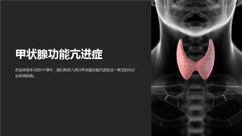 《甲状腺功能亢进症》课件