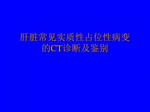 医学影像学肝占位CT鉴别