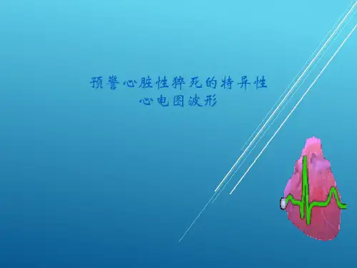 预警心脏性猝死的特异性心电图波形