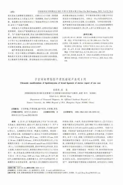 子宫阔韧带脂肪平滑肌瘤超声表现1例