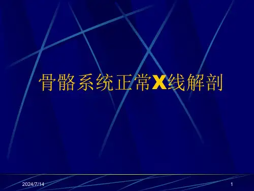 cr骨关节幻灯ppt课件