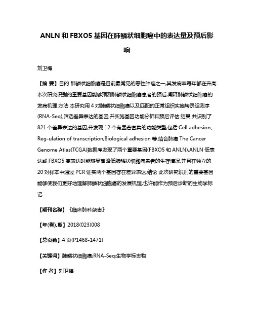 ANLN和FBXO5基因在肺鳞状细胞癌中的表达量及预后影响