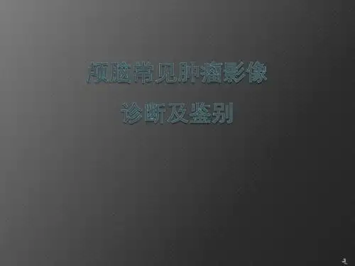 颅脑常见肿瘤影像诊断及鉴别ppt课件