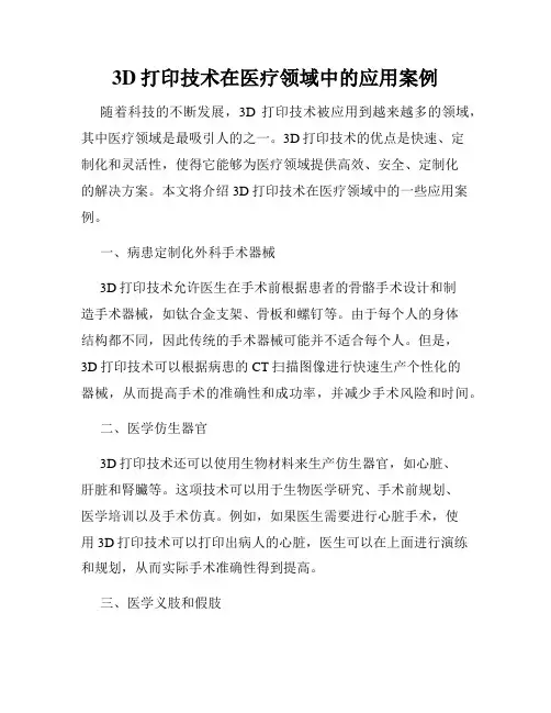 3D打印技术在医疗领域中的应用案例