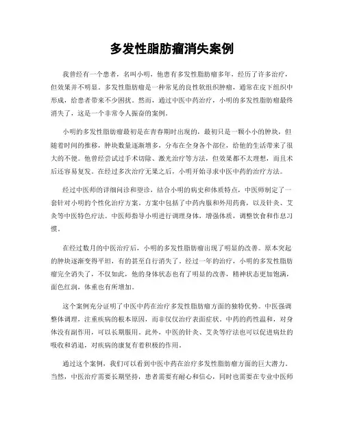 多发性脂肪瘤消失案例