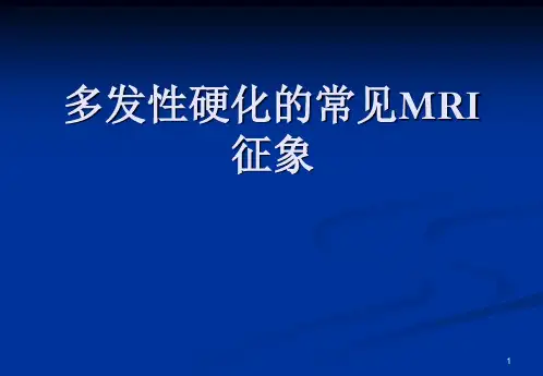 (优质医学)脑多发性硬化的MRI表现
