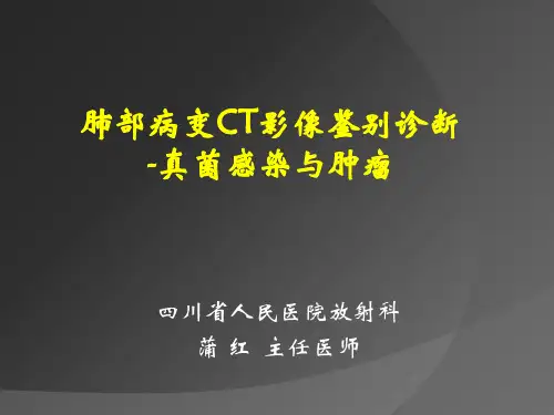 肺部病变影像鉴别诊断-真菌感染与肿瘤3