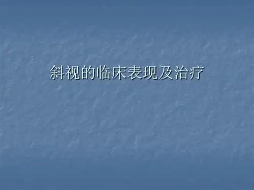 斜视的治疗