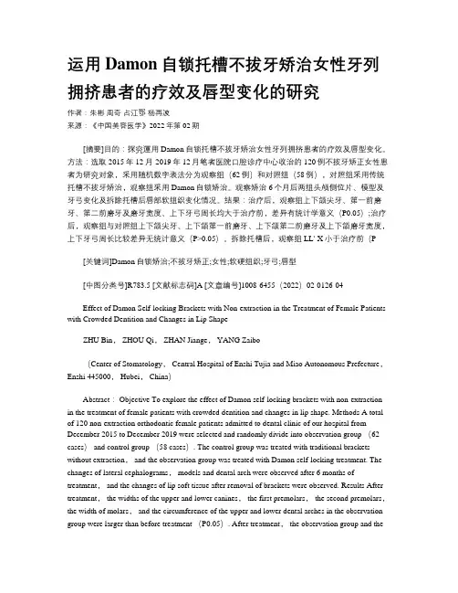 运用Damon自锁托槽不拔牙矫治女性牙列拥挤患者的疗效及唇型变化的研究