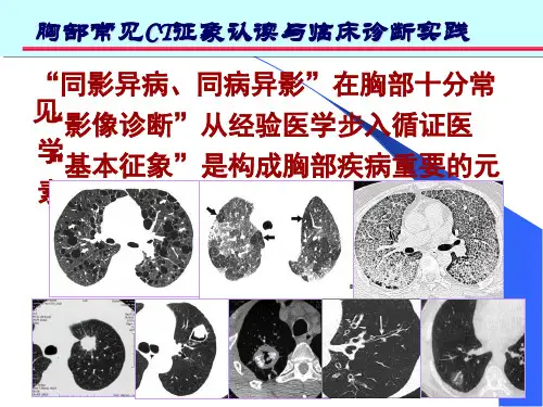 肺部CT十大征象诊断应用培训课件