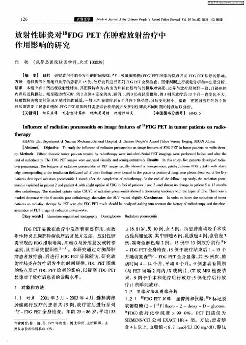 放射性肺炎对 18FDG PET在肿瘤放射治疗中作用影响的研究