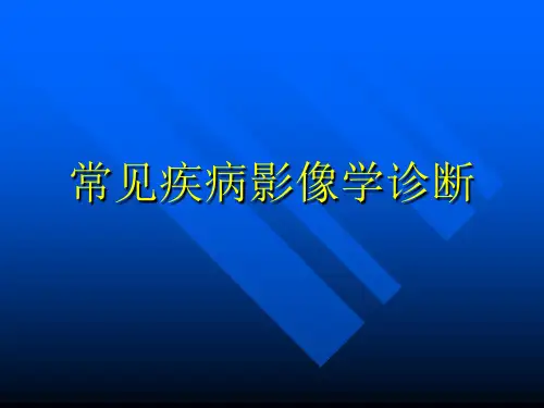 常见疾病影像学诊断