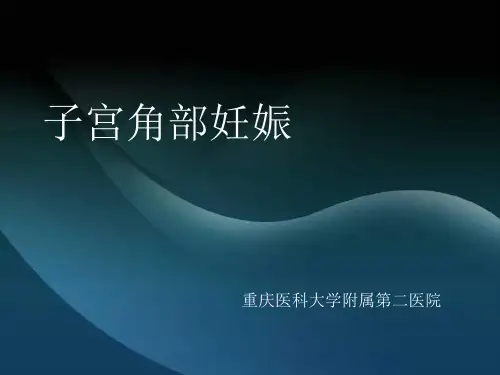 子宫角部妊娠