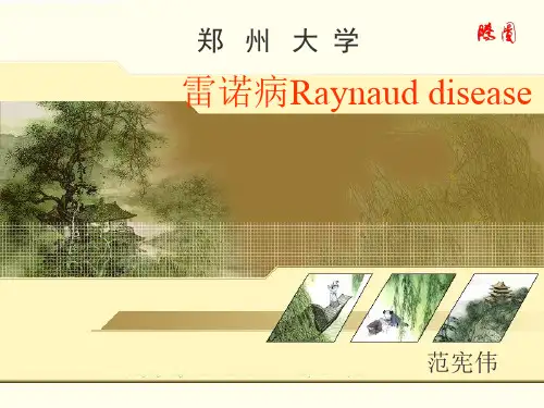 雷诺病.ppt