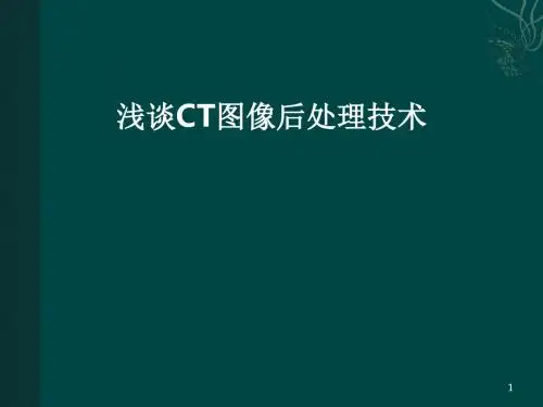 CT图像后处理技术ppt课件