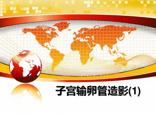 最新子宫输卵管造影(1)教学讲义ppt课件