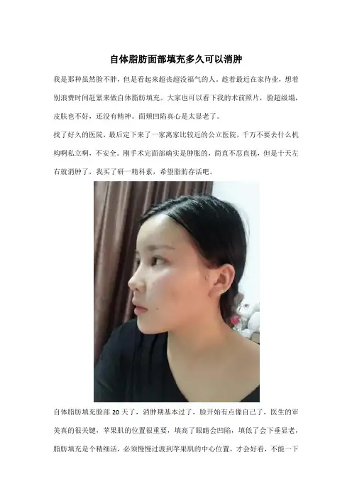 自体脂肪面部填充多久可以消肿