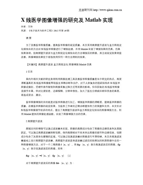 X线医学图像增强的研究及Matlab实现