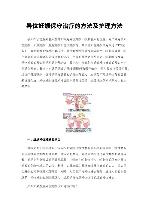 异位妊娠保守治疗的方法及护理方法