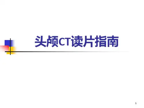 头颅CT最全读片(1)